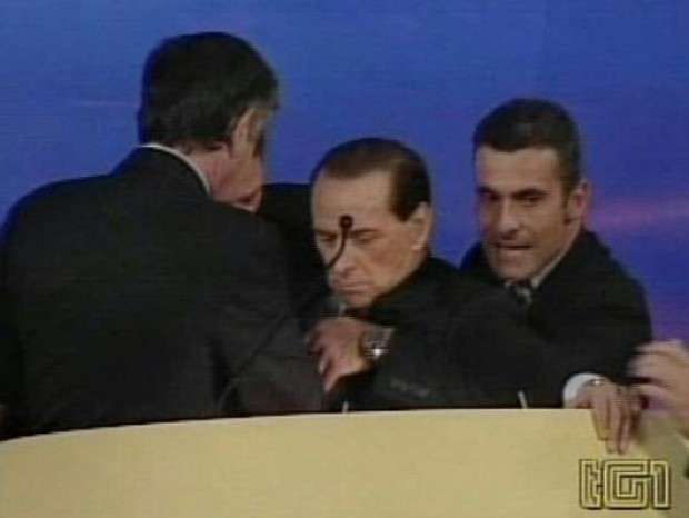 Im Juni 2008 und im Mai 2010 wurde es Berlusconi vor laufenden Kamers übel. 2006. "Tutto bene", sagten die Ärzte.