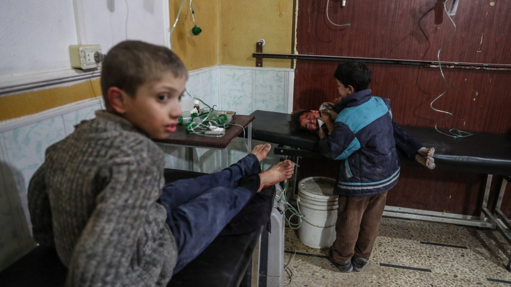 In einem Spital in Douma, Ost-Ghouta in Syrien, erhalten verwundete Kinder am 8. Februar 2018 Erste Hilfe. Gemäss Medienberichten wurden bei den angeblich von der syrischen Luftwaffe ausgeführten Angriffen auf die von Rebellen gehaltenen Gebiete Ost-Ghoutas 75 Menschen getötet. (Keystone/EPA, Mohammed Badra)
