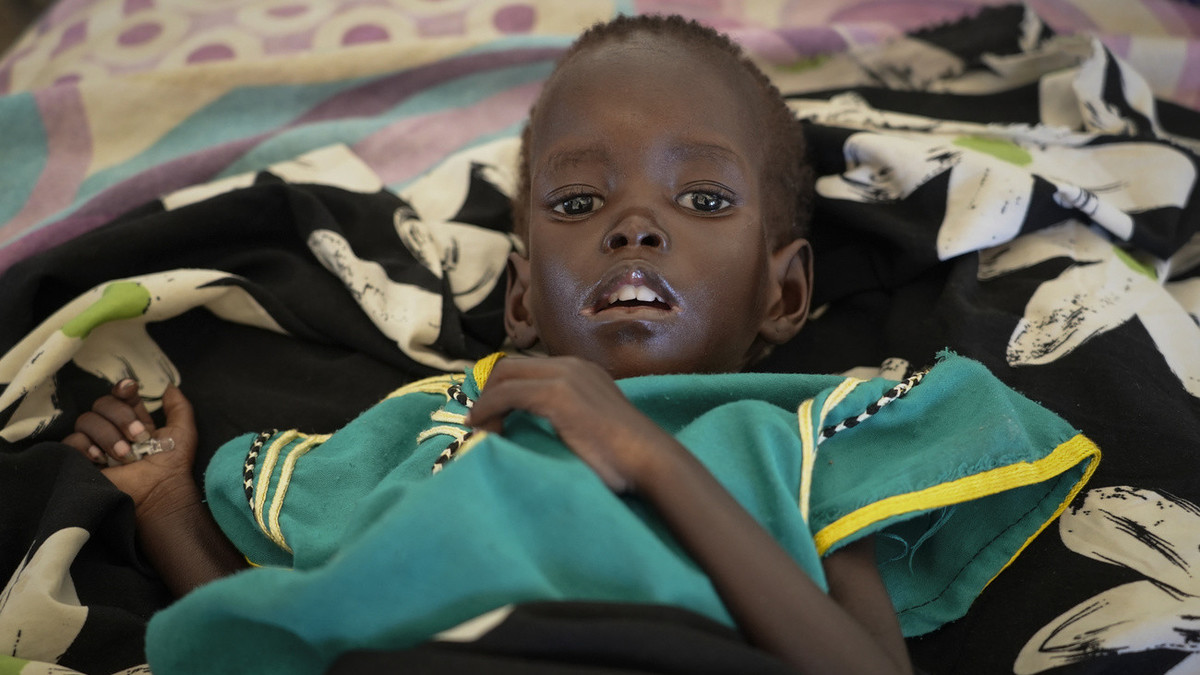 Hunger, Südsudan